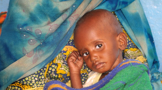 A mother with her severely malnourished child in the Sahel region. Photo: UNICEF/Chad/2012/C Tidey