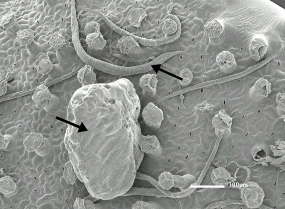 Scanning electron microscope image shows the upper leaf surface of Philcoxia minensis. Arrows point to
nematodes and sand grains.