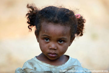 Niña en Madagascar, en donde el 70 por ciento de los niños sufren de desnutrición. Con un crecimiento demográfico en auge, 45 por ciento de los malgaches tienen menos de 14 años de edad. Foto por: Rhett A. Butler.